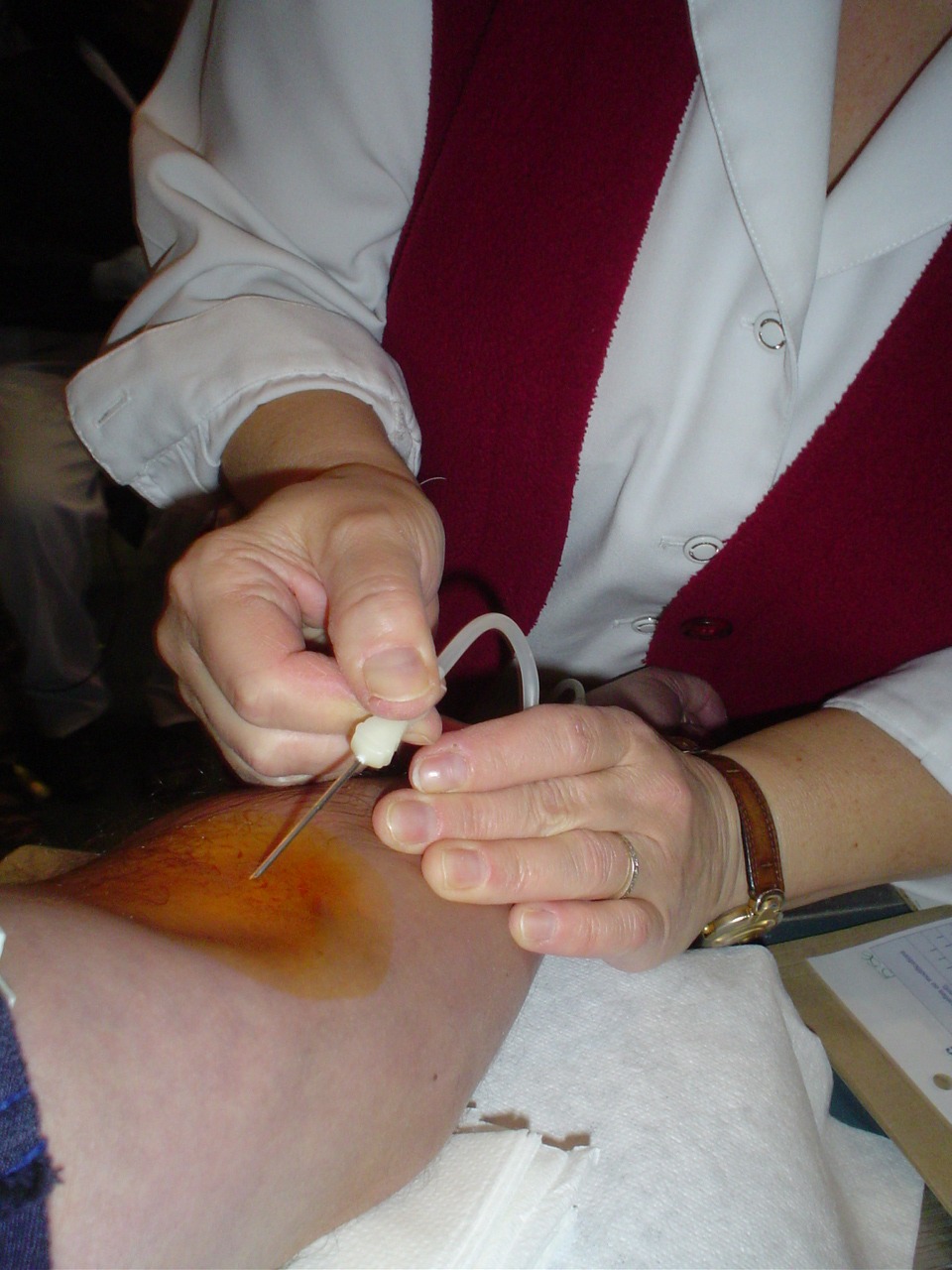 Les donneurs de sang invités à tendre le bras