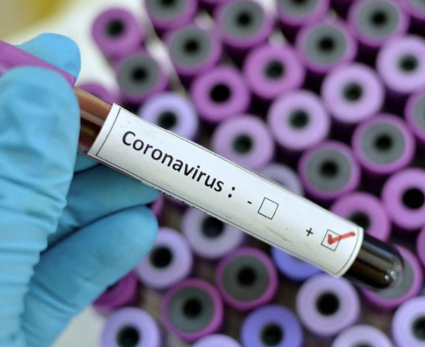 COVID-19: 3 décès dans la région dans la dernière semaine